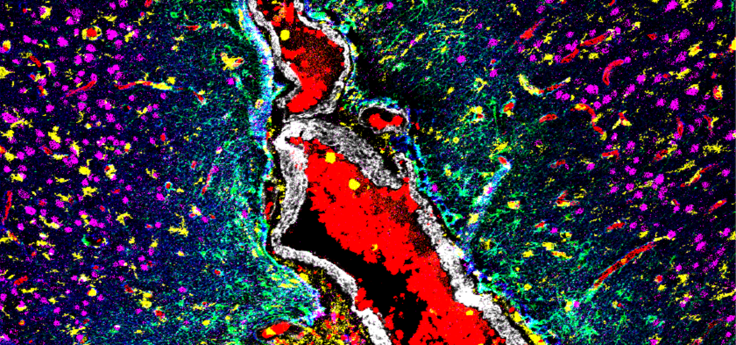 Example Hyperion image of brain tumour cells