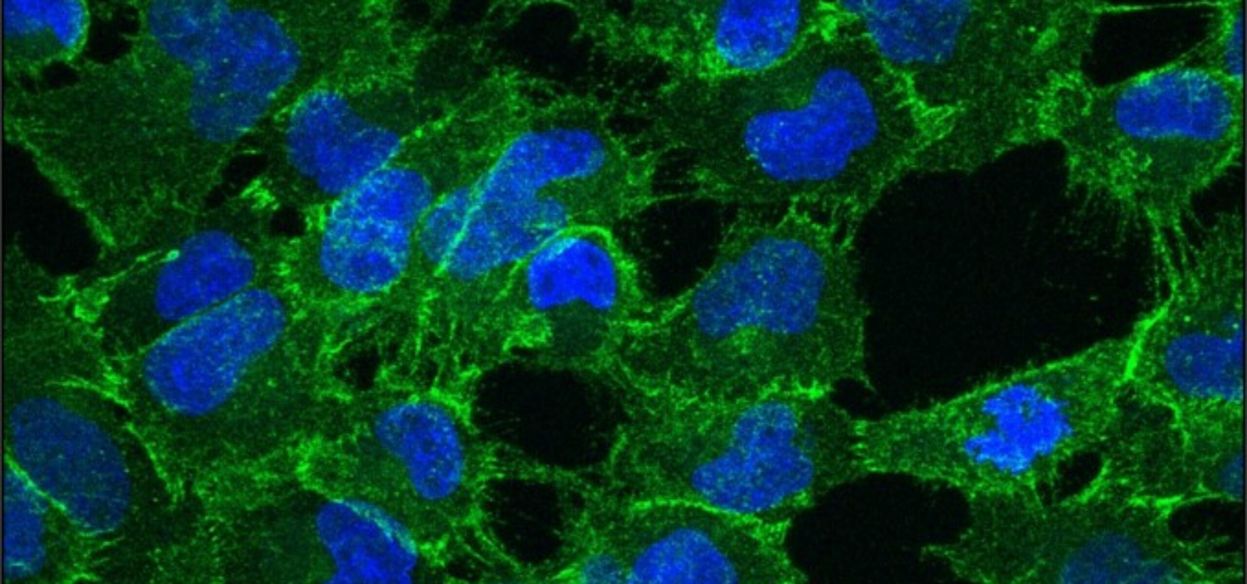 immunofluorescence