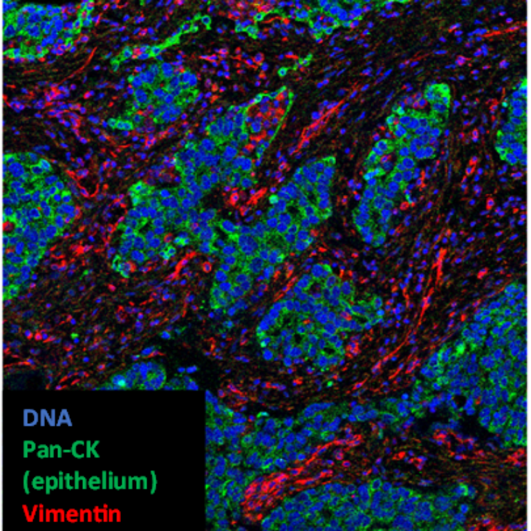 Hyperion IMC (imaging mass cytometry) subcellular imaging courtesy of Laura Woodhouse in collaboration with Couper Lab, University of Manchester.