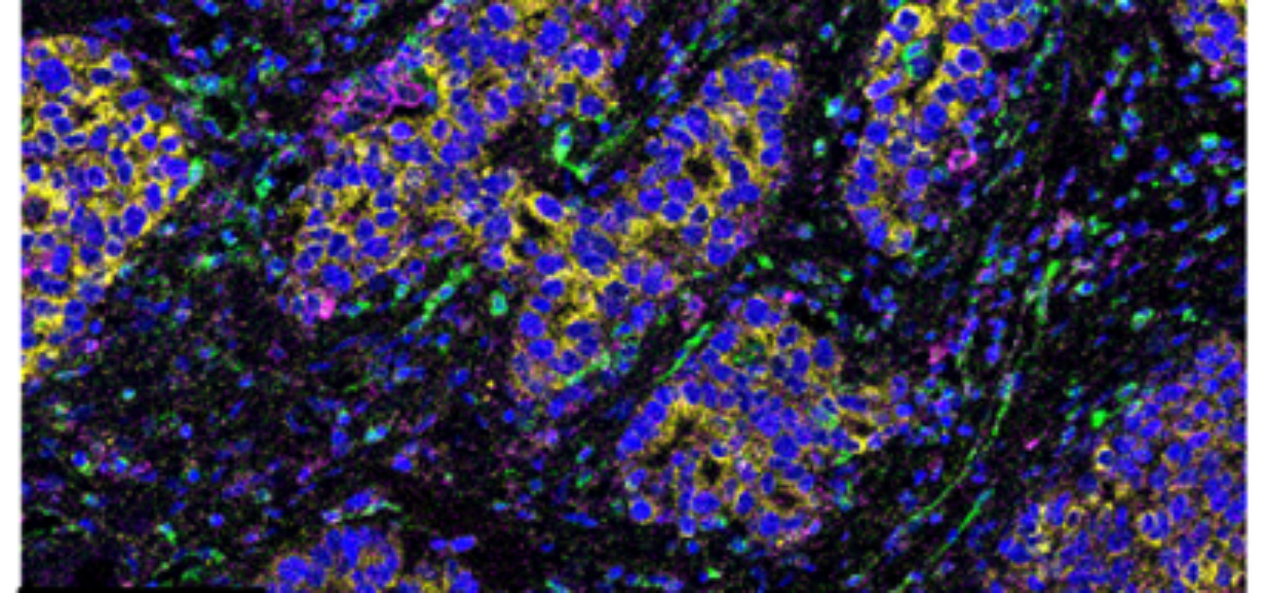 Hyperion IMC (imaging mass cytometry) subcellular imaging courtesy of Laura Woodhouse in collaboration with Couper Lab, University of Manchester.